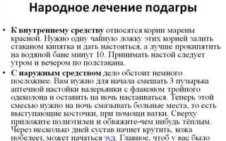 Как лечить подагру в домашних условиях