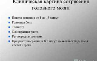 Симптомы сотрясения мозга