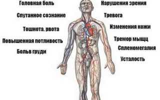 Симптомы гипертонии