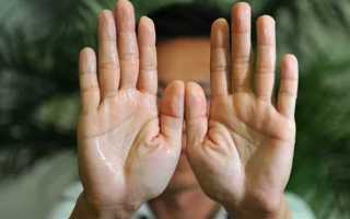 Гипергидроз у детей