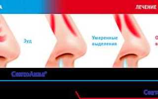 Заложенность носа у ребенка