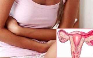 Симптомы воспаления яичников