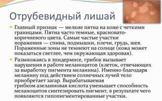 Ключевые слова: лечение, лишай цветной