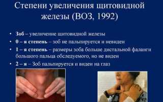 Симптомы увеличения щитовидной железы