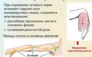 Как лечить лучевой нерв