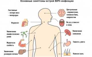 Симптомы вич-инфекции