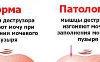 Почему не пройти мимо уринирования?