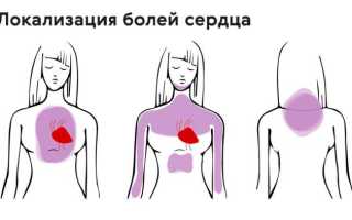Что делать, когда ощущаешь колющие боли в области сердца?