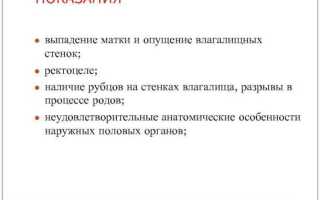 Как эффективно справиться с проблемой выпадения матки
