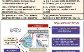 Как избавиться от застоев в груди народными средствами
