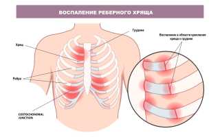Невыносимая боль в области ребер