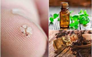 Лечение папиллом народными средствами: эффективные методы и советы