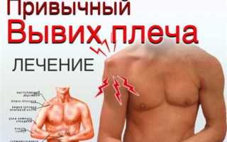 Лечение вывиха плечевого сустава: эффективные методы и рекомендации