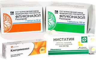 Молочница и способы ее лечения