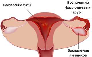 Почему месячные часто идут
