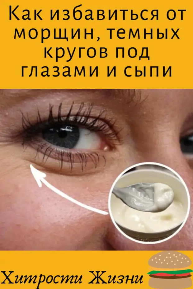 Как избавиться от кругов под глазами Как избавиться от кругов под глазами
