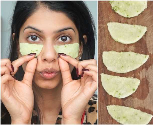 Как избавиться от синяков под глазами в домашних условиях Как избавиться от синяков под глазами в домашних условиях