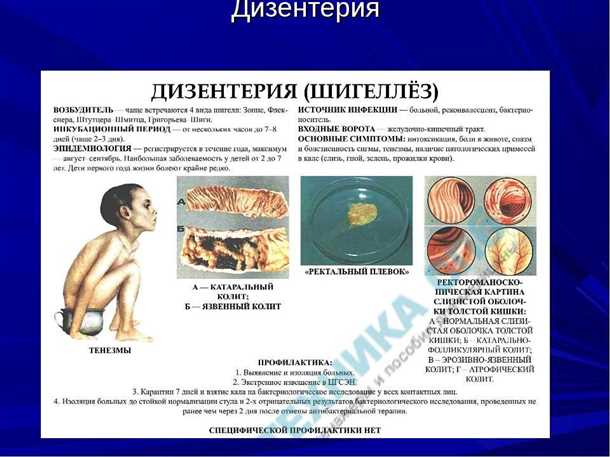 Симптомы дизентерии Симптомы дизентерии