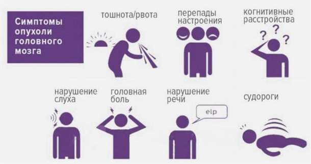 Симптомы опухоли головного мозга