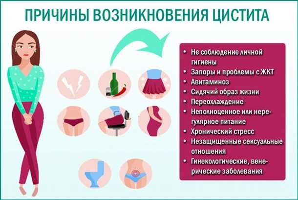 Симптомы цистита у женщин