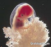 Избавляемся от нежелательной беременности народными средствами фото Избавляемся от нежелательной беременности народными средствами фото