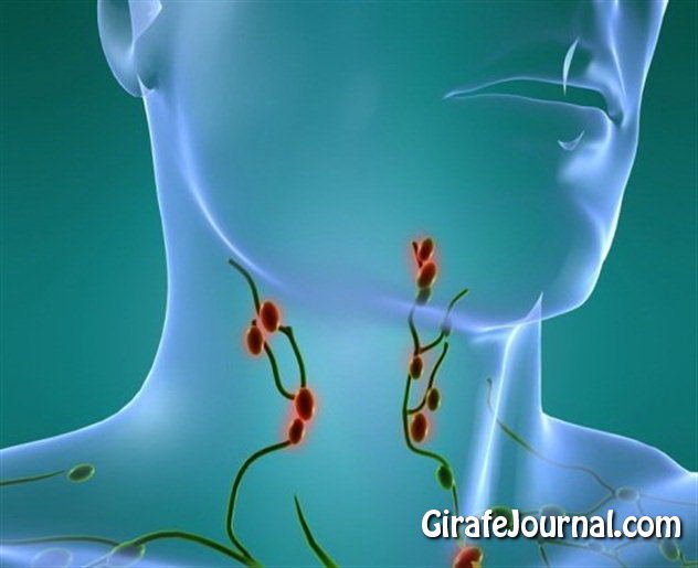 Как вылечить лимфоузлы на шее? фото