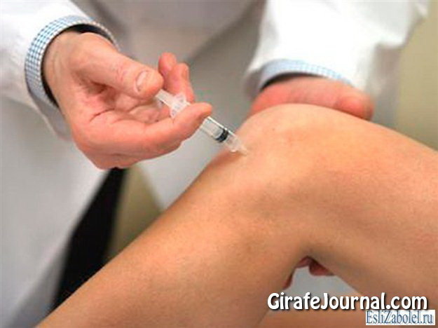 Как лечить артроз фото Как лечить артроз фото